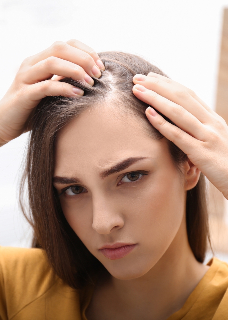 CBD und die seborrhoische Dermatitis: Was ist das Wichtigste zu wissen?