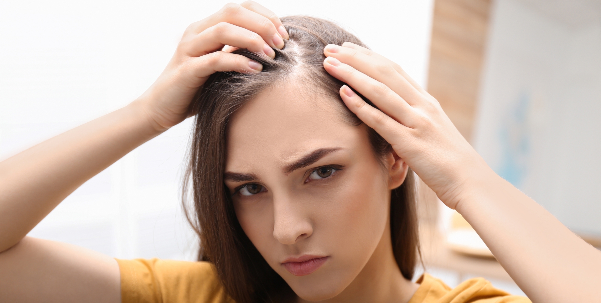 CBD und die seborrhoische Dermatitis: Was ist das Wichtigste zu wissen? image